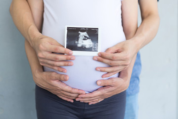 Happy couple are holding the baby ultrasound photo.