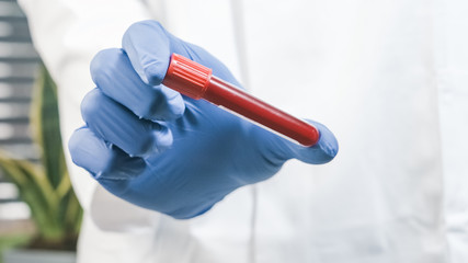 Doctor holding blood sample tube for testing in protective gloves in a laboratory.