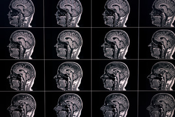 MRT images of a human brain