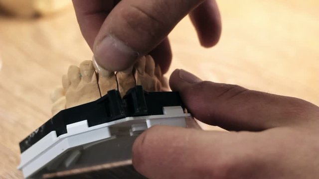 A man takes off his teeth with the layout of a dental prosthesis, Full HD