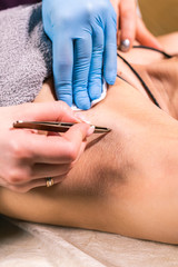 Close-up of removing armpit hair with tweezers. Female depilation. Cosmetology and beauty shop concept.