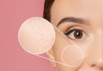 Young woman with dry skin on pink background, closeup