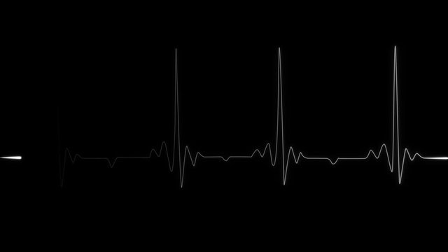 Pulse Line Heartbeat. Cardiac Arrest. Realistic Animated Heart Rhythm Cardiogram