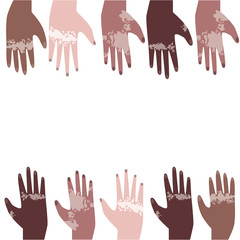International hands with dermatological Vitiligo disease are raised up and place for text as a concept of unity, flat vecanoran glass art illustration with hands, vitiligo