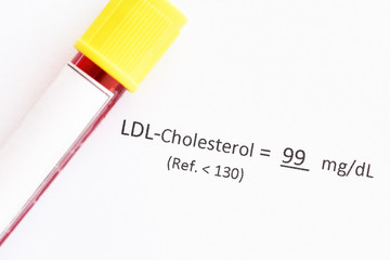 Blood sample tube with LDL-cholesterol test result