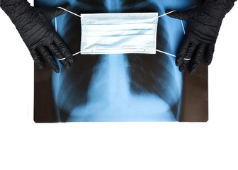 Blue respiratory mask on x-ray of human lungs in hands in black gloves, Close up. Coronavirus Covid-19 disease concept. Pandemic insurance, airborne diseases