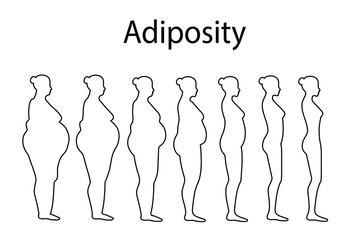 Vector illustration of obesity. Stages of obesity in women
