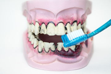 Toothbrush cleaning wooden dentures with caries and cavities on white background with copy space.  Dental Health care.