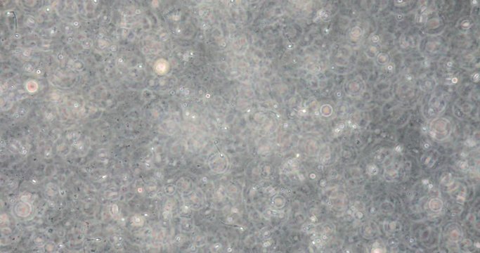 Human semen in phase contrast microscope