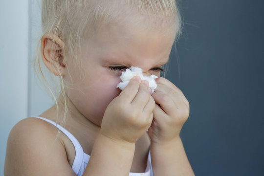 Close Up Candid Portrait Of Toddler Girl Blowing Nose. Runny Nose Caused By Cold, Flu Or Allergy.