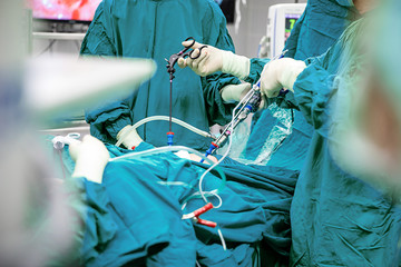 Surgeons team hands during laparoscopic abdominal operation in patient surgery in operating room