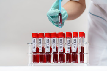 medical doctor nurse woman working with virus blood tests rack