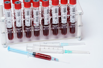 Rack of Tubes of blood sample for testing biological material