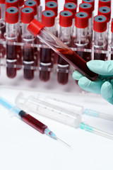 Rack of Tubes of blood sample for testing biological material