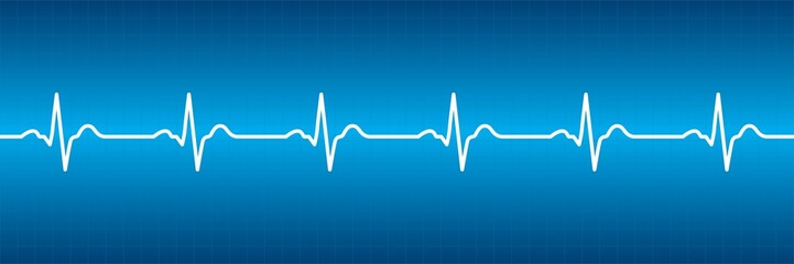 Graphic material representing an electrocardiogram