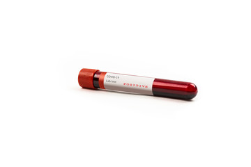 Test tube containing a blood test sample over white background