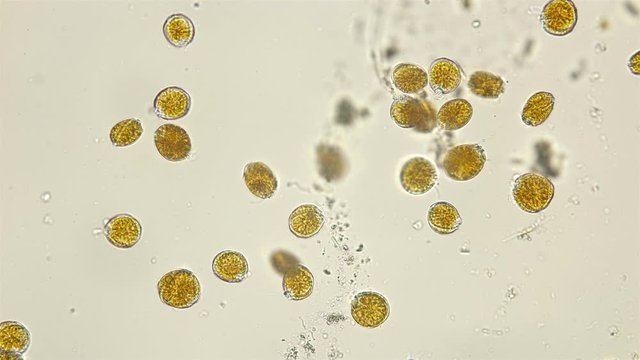 phytoplankton of the Black Sea, a colony of algae Dinoflagellata, or they are also called parasitic flagellates, mainly free-living photosynthetic organisms,