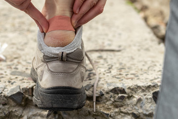 A pedestrian tourist glues a patch on his foot. Close-up photo.
