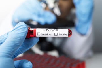 Obraz premium Cropped view of scientist in latex glove holding test tube with blood sample, Test tube with blood sample for COVID-19 test, novel coronavirus 2019