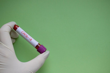 hand in a disposable medical glove holds a test tube with coronavirus test