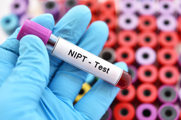 Blood sample tube for NIPT test or non-invasive prenatal testing, diagnosis for fetal Down syndrome in pregnancy woman - obrazy, fototapety, plakaty