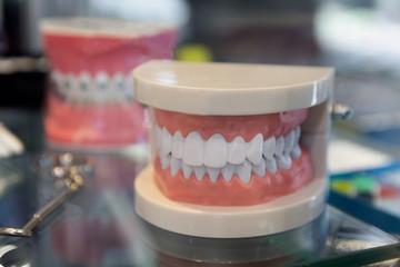Dental model of the human jaws. Stomatology