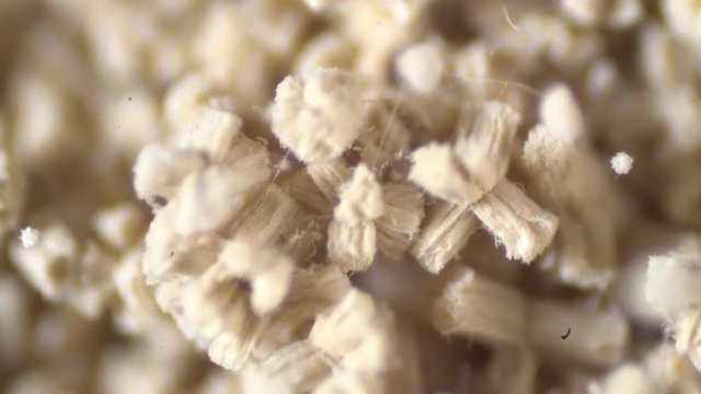 Aspergillus (mold) under microscope view in laboratory.