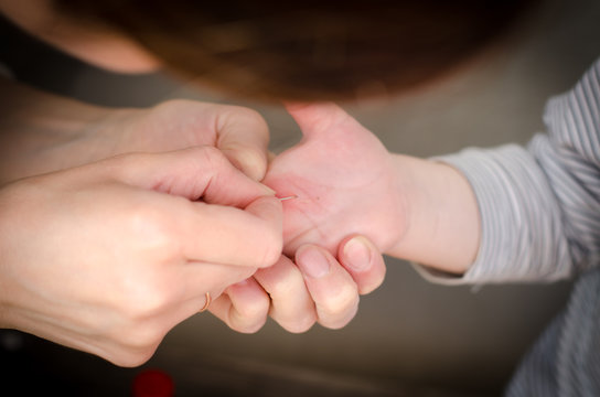 A splinter in the hand of a child. Girl pulls a splinter from the hands of a child.