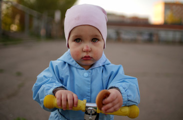 Upset little girl in blue jumpsuit with scratch on her nose