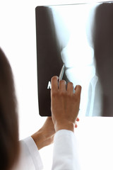 Female black doctor hold in arm and look at xray photography discussing it with female patient portrait. Bone disease exam medic assistance cancer test healthy lifestyle hospital practice concept