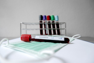 Professional doctors perform COVID-19 tests from samples of blood tests to diagnose coronary virus...