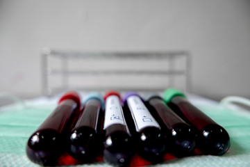 Professional doctors perform COVID-19 tests from samples of blood tests to diagnose coronary virus...