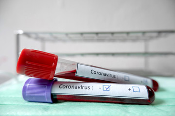 Professional doctors perform COVID-19 tests from samples of blood tests to diagnose coronary virus infections analysis and sampling of infectious diseases medical concepts and health care