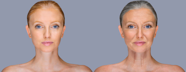     Comparison. Portrait of beautiful woman with problem and clean skin, aging and youth concept, beauty treatment