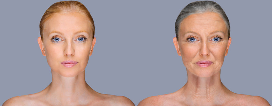     Comparison. Portrait of beautiful woman with problem and clean skin, aging and youth concept, beauty treatment