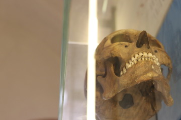 the skull