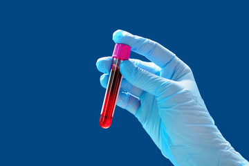Test tube with blood in the hand isolated on blue background.  Medical gloves, analysis, medical test, vaccine, research