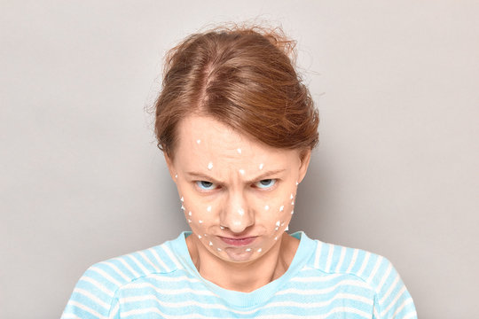 Portrait of funny angry girl with white drops of face cream on skin