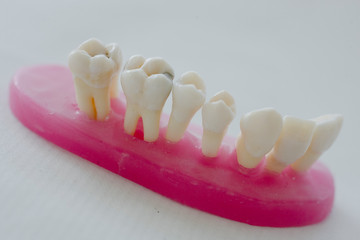 Atelier fabication de prothéses dentaire