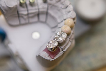 Atelier fabication de prothéses dentaire