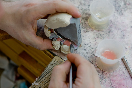 Atelier fabication de proth&eacute;ses dentaire