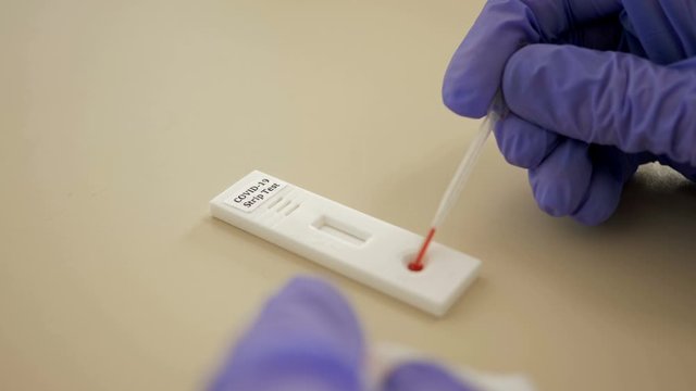 The lab technician does an express blood test using Strip Test. 10-Min Coronavirus diagnostic.