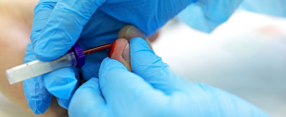 a doctor does a blood test for patients to identify a disease