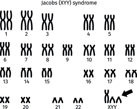Scheme of Jacobs (XYY) syndrome karyotype of human somatic cell 47XYY