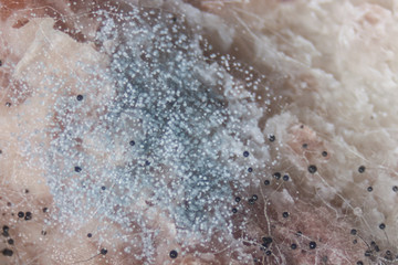 Backgrounds Colony Characteristics of Rhizopus (bread mold) is a genus of common saprophytic fungi, Rhizopus (bread mold) under the microscope.
