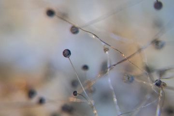 Backgrounds Colony Characteristics of Rhizopus (bread mold) is a genus of common saprophytic fungi, Rhizopus (bread mold) under the microscope.
