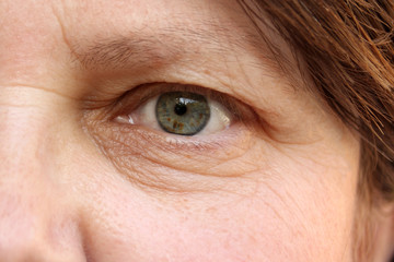green eye with brown spots on the face of an elderly woman, small wrinkles on the eyelids, overhang, the concept of age-related changes in human skin