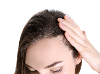 Fototapeta premium Woman with dandruff in her hair on white background, closeup