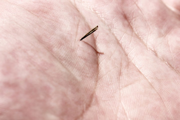 Splinter palm skin. Hand background for medical remove spike.