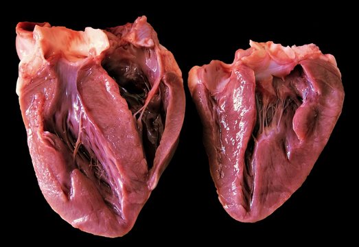 A Heart Sectioned In Two